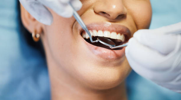 Best Walk-In Emergency Dentist in Wabasso, FL